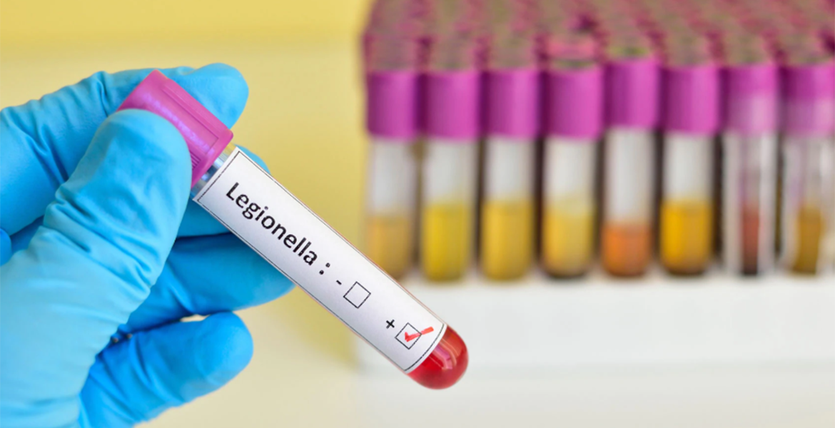Legionella: Il rischio biologico in ambiente di lavoro